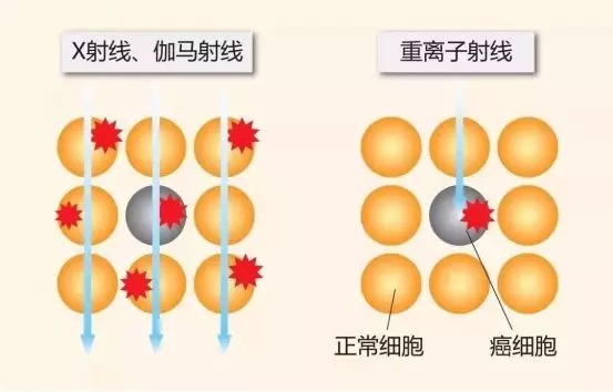 質(zhì)子重離子技術(shù)醫(yī)療險可以報銷嗎？